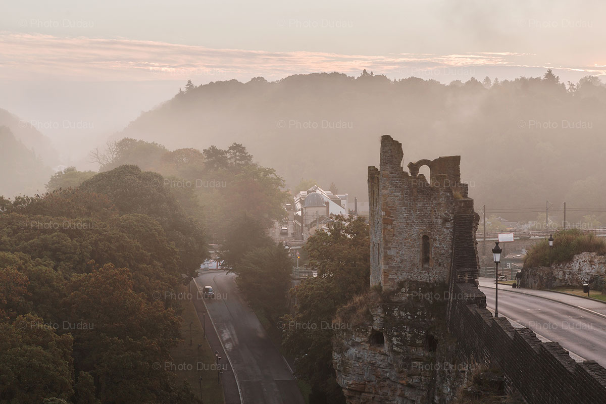 hollow tooth huelen zant luxembourg city